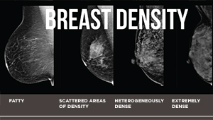 Breast density scans