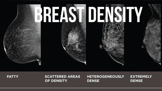 Breast-cancer-screening_breast-density_2col.jpg